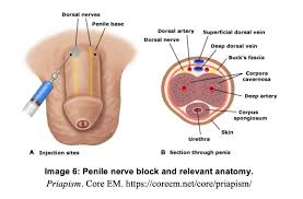 Image result for Genitourinary Trauma