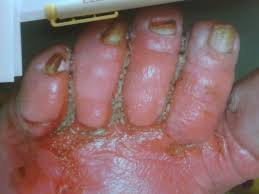 I use to be a cosmetologist did this for 10 yes i loved my job the money was awesome above all i loved me! Myiasis Doccheck