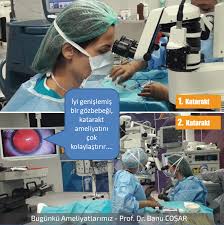 Katarakt Ameliyati Oncesinde Goz Bebegi Damlalarla Genisletilir Iyi Genislemis Bir Goz Bebegi Katarakt Ameliyatini Teknik Olarak Cok K Gozler Bilgi Doktorlar