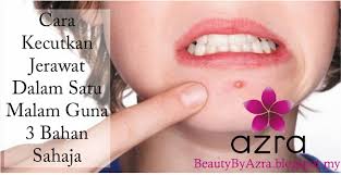 Salah satunya adalah teh hijau. Beauty By Azra Cara Kecutkan Jerawat Dalam Satu Malam Gunakan 3 Bahan Sahaja