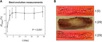 Sir, your hands were in your pockets. Ex Vivo Assessment And In Vivo Validation Of Non Invasive Stent Monitoring Techniques Based On Microwave Spectrometry Scientific Reports