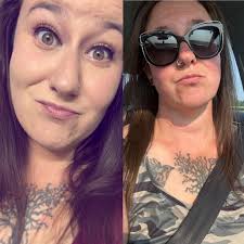 Bariatric surgery one month progress and goals