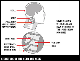 Neck Pain Causes Exercises Treatments Versus Arthritis