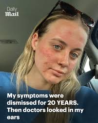 ellie, if she was never immune 🤣