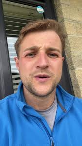 Recovery Journey: Keep Going One Day at a Time