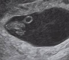 Nasenhaut (wachshaut) altersunterschiede rosa (pink) färbung der wachshaut bei bestimmten farbschlägen. 10 Anzeichen Die Angeblich Babys Geschlecht Verraten