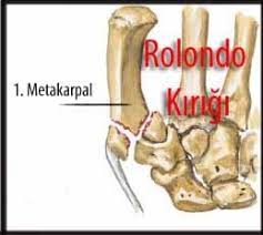 El Bilegi Kiriklari Distal Radius Ulna Kiriklari Fizyoo Fizyoterapi Elsa