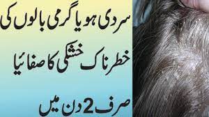 Hair dandruff treatment, balon ki khushki ka ilaj in urdu hindi beauty tips and health tips by memoona muslima a student of naturopathy 2016. Remove Dandruff Permanently Fast In 2 Days Naturally By Home Remedy Youtube