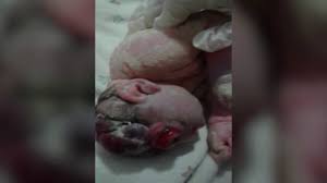 Radiation exposure from depleted uranium: The Endless War Iraq S Heavy Legacy Of Depleted Uranium Sasa Post