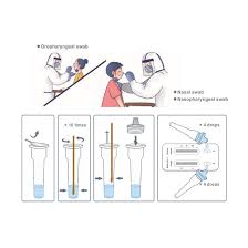 Antigen tests are currently authorized to be performed on nasopharyngeal or nasal swab specimens placed directly into the assay's extraction buffer or reagent. Sars Cov 2 Influenza Antigen Rapid Test Kit A254397
