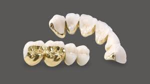 It is implemented by the state governments. High Intensity Yellow Gold Dental Pfm Crown All Teeth Indication China Pfm Dental Made In China Com