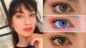 Renkli Lens Alacak Kisiler Nelere Dikkat Etmelidir Ozel Esencan Hastanesi
