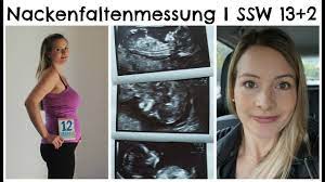 Ssw ist genau der richtige zeitpunkt für die nackenfaltenmessung (nackentransparenzmessung). Nackenfaltenmessung I Ergebnis I Kosten I 14 Ssw I Schwangerschaftsupdate Youtube
