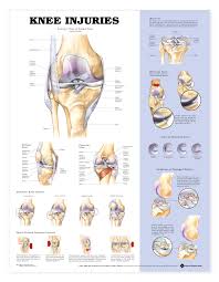 Knee Injuries Anatomical Chart