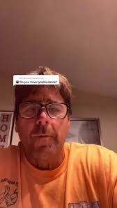 What Happened to Jeff Dabe