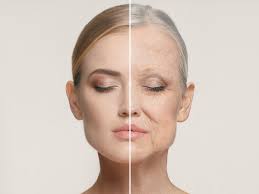 Want To Look Younger Here Are 7 Effective Home Remedies To Get Wrinkle Free Skin Health Tips And News