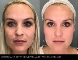 Enlighten Mask: Revitalize Your Skin