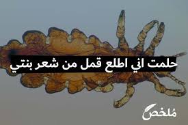 حلمت اني اطلع قمل من شعر بنتي 2021 موقع ملخص