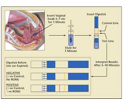 Image result for AmniSure ROM Test