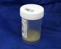 Image result for Sputum