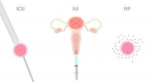 E' anche possibile usare il seme del donatore durante una procedura di fecondazione in vitro (fivet). Inseminazione Artificiale Cos E E Come Funziona Gruppo Donnamed