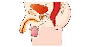 Check spelling or type a new query. Male Reproductive System Bioninja