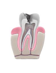 Baby Tooth Extractions Causes Procedure Aftercare
