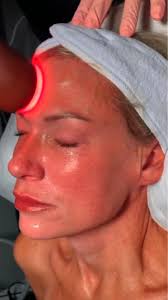 Fresh, smooth, and radiant—because your skin deserves it. , #medspa  #skincare #facial #facialtreatement #facialcare #nonsurgicalfacelift  #spaday #antiage #antiwrinkle #antiageing