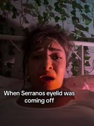 Me Covering My Face When I Saw Serrano's Eyelid Hanging During The Fight