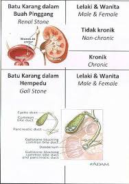 Penyakit batu karang hempedu adalah masalah yang sering dihadapi penduduk malaysia. Dr Jetox Tanda Dan Gejala Batu Karang Hempedu Yang Teliti Sila Membaca Sila Membaca Sila Membaca Ini Mungkin Menandakan Serangan Penyakit Batu Karang Hempedu Akan Berlaku Rasa Sakit