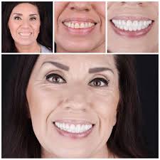 Order your smile my for today and tomorrow N$200 0814938040