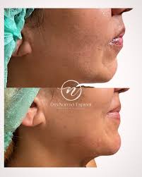 Dra. Norma Espinal. Md.Cirujano/ Md.Estetica