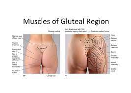 SOLUTION: ALL IN ONE- muscles of the gluteal region simplified. - Studypool