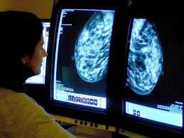 All women who are 50 to 70 years of age should be screened for breast cancer every 3 years as part of the nhs breast screening programme. 10 000 Fewer Patients Began Breast Cancer Treatment Over Past Year Study Shows The Independent