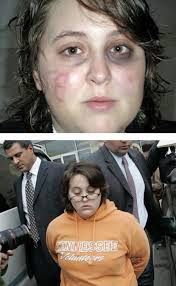 Ashley Todd, arrested in 2008 after carving a 'B' in her face and blaming  an Obama supporter. : r/pics