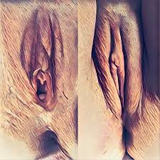 Lazerle Vajina Daraltma Ameliyatı (Vajinoplasti) | Jin. Dr. Yeşim Yerçok