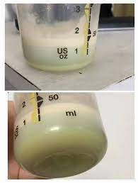 Anak kedua, aisy, alhamdulillah, ummi berjaya susukan sepenuhnya dengan susu ibu selama setahun dua bulan. Tanda Susu Ibu Rosak