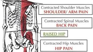 Low back extensor muscles, such as the erector spinae, must eccentrically contract to slow your body's descent as you flex forward, then isometrically one example of this is the posture of the hip joint when sitting. 3 Reasons Your Low Back Pain Is A Problem In Your Neck