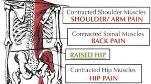 The hip flexors are muscles that extend from the hips to the knees. 3 Reasons Your Low Back Pain Is A Problem In Your Neck