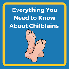 Image result for Chilblains