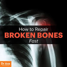 Foods Supplements Oils To Increase Bone Healing Dr Axe Bone Healing Heal Broken Bones Broken Bone
