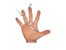 Image result for phlegmon of hand)