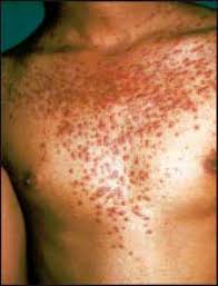 Dioxins are called persistent organic pollutants (pops), meaning they take a long time to break down once they are in the environment. Jaypeedigital Ebook Reader