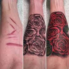 Should you tattoo over your scar? Scars Cover Up Done By Chris Atticus Tattoo In Calgary Ab Tattoos