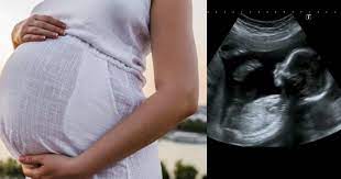 Misalkan anda ingin mendaftarkan bayi dalam kandungan maka harus daftar bersama istri anda. Darah Tinggi Masa Mengandung Boleh Menyebabkan Tumbesaran Bayi Dalam Kandungan Terbantut Pa Ma