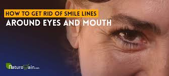 Smile lines are wrinkles or folds that occur between the nostrils and the corners of the mouth. How To Get Rid Of Smile Lines Around Eyes And Mouth Naturally