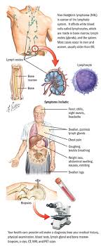 If i go deep enough i think i if it gets bigger you should be concerned, not necessarily about cancer, but that you might need some about the lymph nodes, it is completely normal that you can feel them on different part of your body. Hodgkin And Non Hodgkin Lymphoma Blood Cancer Spectrum Health