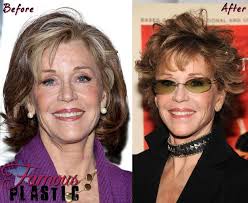 That it's time to stop seeking acceptance through surgery and try to find it by reaching inside. Jane Fonda Is 75 Years Old She S Been Pretty Open About Her Plastic Surgery Procedures B Jane Fonda Plastic Surgery Celebrity Plastic Surgery Plastic Surgery