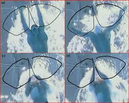 How to swim faster breaststroke. How To Correct Your Breaststroke Swimming Mistakes With Best Technique Aboutswim