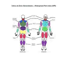 Ea este mai răspândită la femei decât la bărbați. Fibromialgia Que Es Sintomas Diagnostico Y Tratamiento